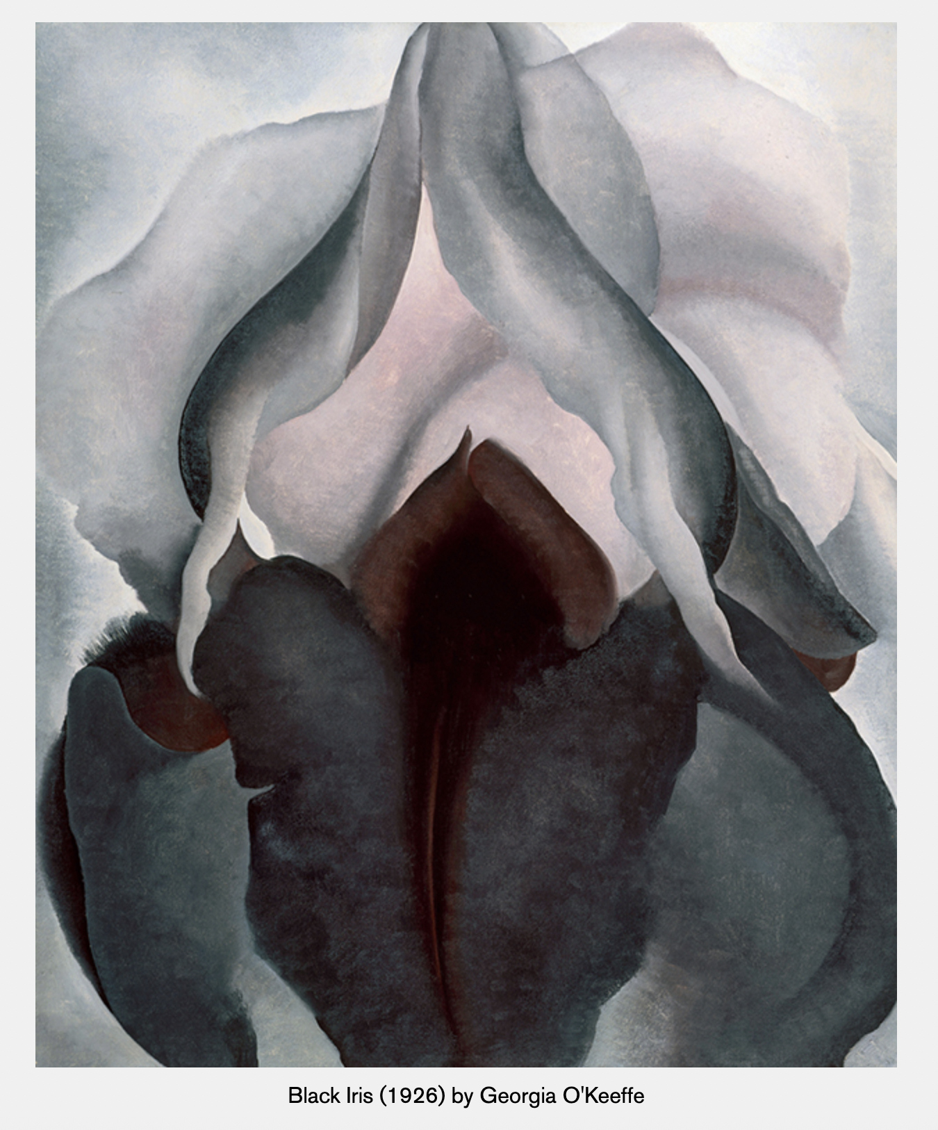 (GSM) Genitourinary Syndrome of Menopause